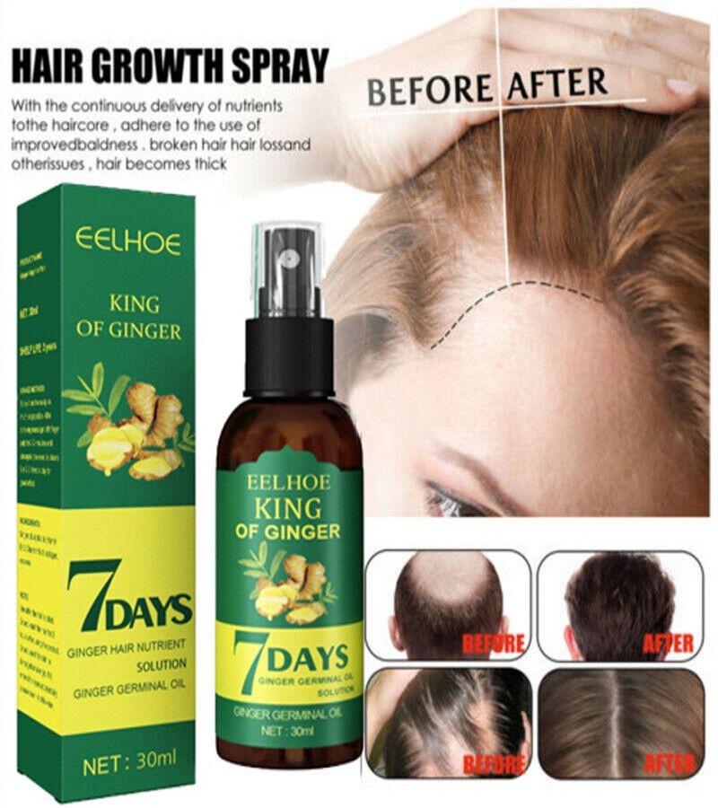 7 Days Hair Growth Spray – Germinal Serum Oil 30ML