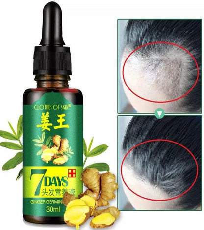 7 Days Hair Growth Spray – Germinal Serum Oil 30ML