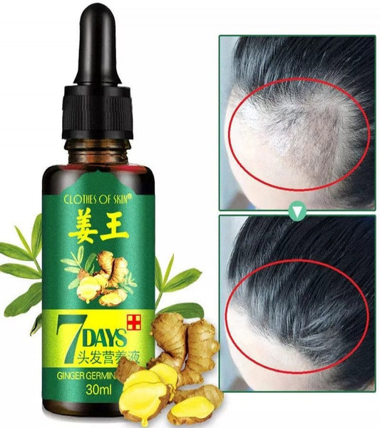 7 Days Hair Growth Spray – Germinal Serum Oil 30ML